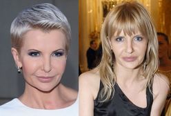 Joanna Racewicz: jej twarz ewoluuje!