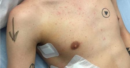 Tatuaż na ciele wywołał zamieszanie na sali operacyjnej. Chirurg nie wiedział gdzie ciąć
