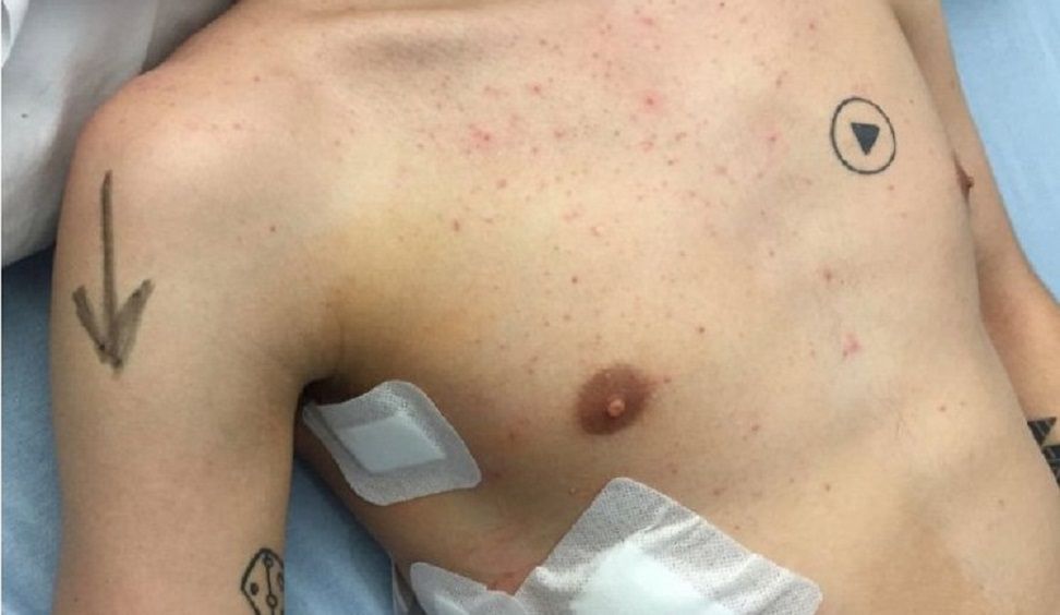 Tatuaż na ciele wywołał zamieszanie na sali operacyjnej. Chirurg nie wiedział gdzie ciąć