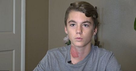 14-latek padł ofiarą niebezpiecznego żartu. Nowy trend mógł kosztować go życie