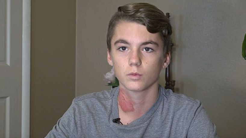 Nickolas padł ofiarą żartu kolegów