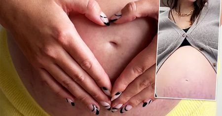 Supermodelka pokazała poznaczony rozstępami brzuch. "Jak drzewo życia". Internauci pod wrażeniem odważnego zdjęcia