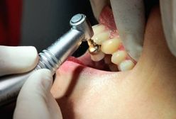 Dentofobia - dlaczego faceci boją się dentysty?