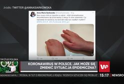 Koronawirus. Posłanka pokazała poranione ręce córki. Czy dzieci muszą używać płynu do dezynfekcji? Lekarz wyjaśnia wątpliwości
