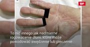 Bolały ją dłonie. Diagnoza była poważniejsza, niż ktokolwiek się spodziewał