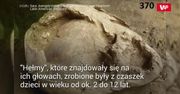 Niemowlę w "hełmie" z czaszki. Porażające odkrycie
