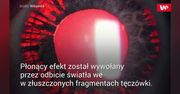 Okulista zbadał oko. Od razu wysłał pacjenta na operację