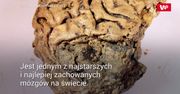Mózg sprzed 2,6 tys. lat może pomóc w walce z demencją