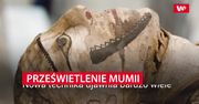 Prześwietili rękę mumii promieniami X. Naukowcy zachwyceni efektami