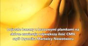 Dlaczego dojrzałe banany są zdrowe?