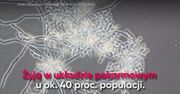 Produkty, które pomagają zwalczać grzyby Candida