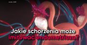Jakie schorzenia może imitować endometrioza?