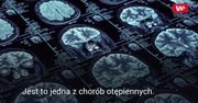 Sposoby na obniżenie ryzyka alzheimera