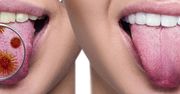Zła higiena jamy ustnej może przyczynić się do raka trzustki