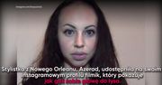 Stylistka ogoliła głowę na łyso – ma ważne przesłanie