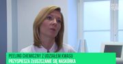 Peelingi chemiczne na jesienne odświeżenie skóry [Specjalista radzi]