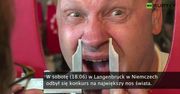 Tak wygląda posiadacz największego nosa na świecie