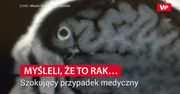 Myśleli, że to rak. Szokujący przypadek medyczny