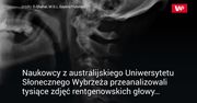 Korzystanie z komórki zmienia nasz szkielet. Najnowsze doniesienia naukowców