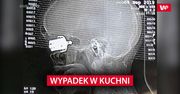 Wypadek w kuchni