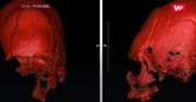 Makabryczne odkrycie. Ich czaszki jasno wskazują, kim byli