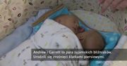 Bliźnięta syjamskie o wspólnym sercu