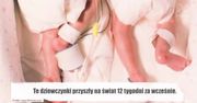 Niezwykłe zdjęcie bliźniaczek