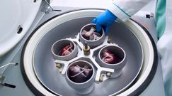 Czy terapia komórkami macierzystymi jest skuteczna?