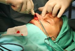 "Sekrety Chirurgii": Szokujący program już w Polsce!