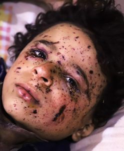 Rosjanie ogłosili humanitarne zawieszenie broni w Damaszku. To jedynie krótka przerwa w masakrze