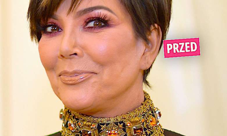 Kris Jenner metamorfoza