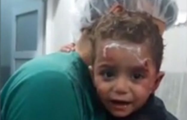 Agonia syryjskich dzieci na poruszającym wideo. Zakrwawiony chłopczyk przytula się do lekarza i nie chce go puścić