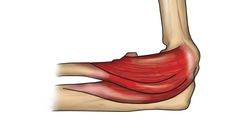 Prostowniki nadgarstka