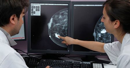 Sztuczna inteligencja wykrywa raka piersi lepiej niż lekarze