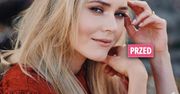 Magdalena Lamparska pozbyła się włosów. Aktorka została łysa, to wszystko w słusznej sprawie