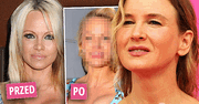 Co się stało z twarzą Pameli Anderson? Zdecydowanie przesadziła z botoksem! Wygląda jak siostra Renee Zellweger