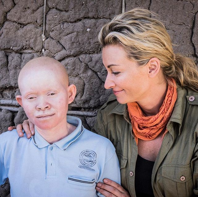 "Zdechł, bo zaraził się albinizmem". Nie tylko Kabula ma w życiu pod górkę