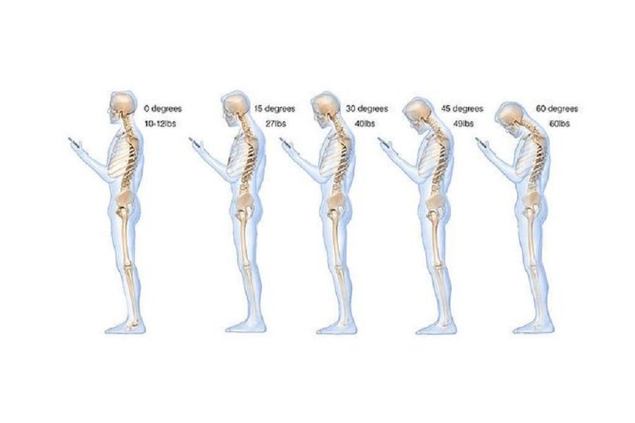 Pozycja głowy w trakcie korzystania z telefonu a jej nacisk na kark. 