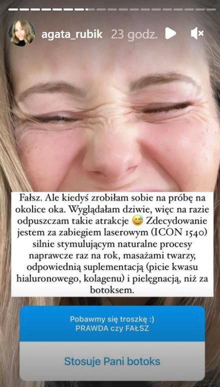 Agata Rubik o eksperymencie z botoksem