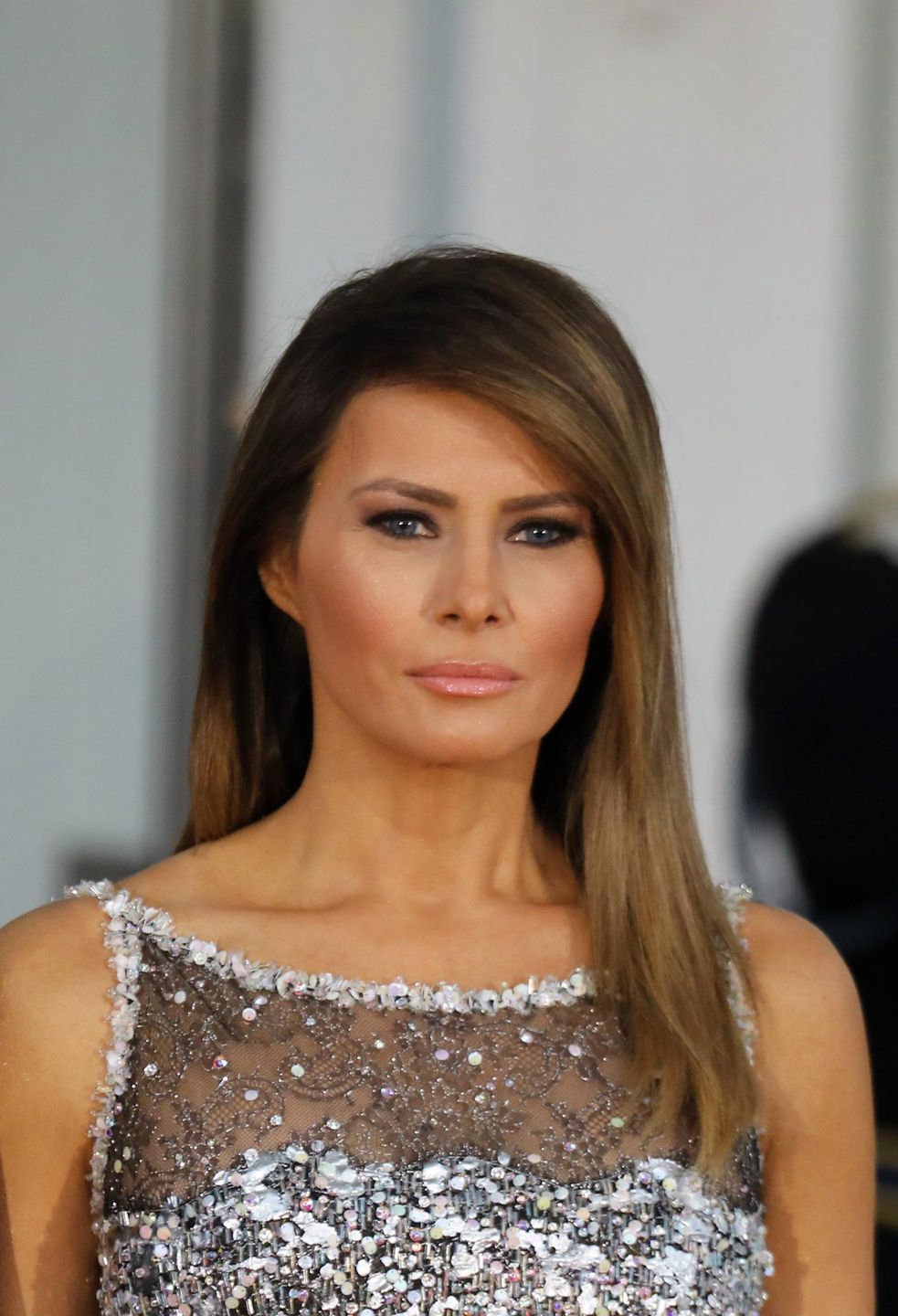 Melania Trump ma problemy z nerką