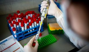 Koronawirus. Polska opracuje swój test na SARS-CoV-2
