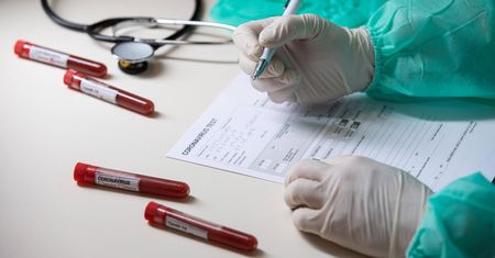 Celon Pharma wyprodukuje testy na koronawirusa. Akcje na giełdzie wystrzeliły