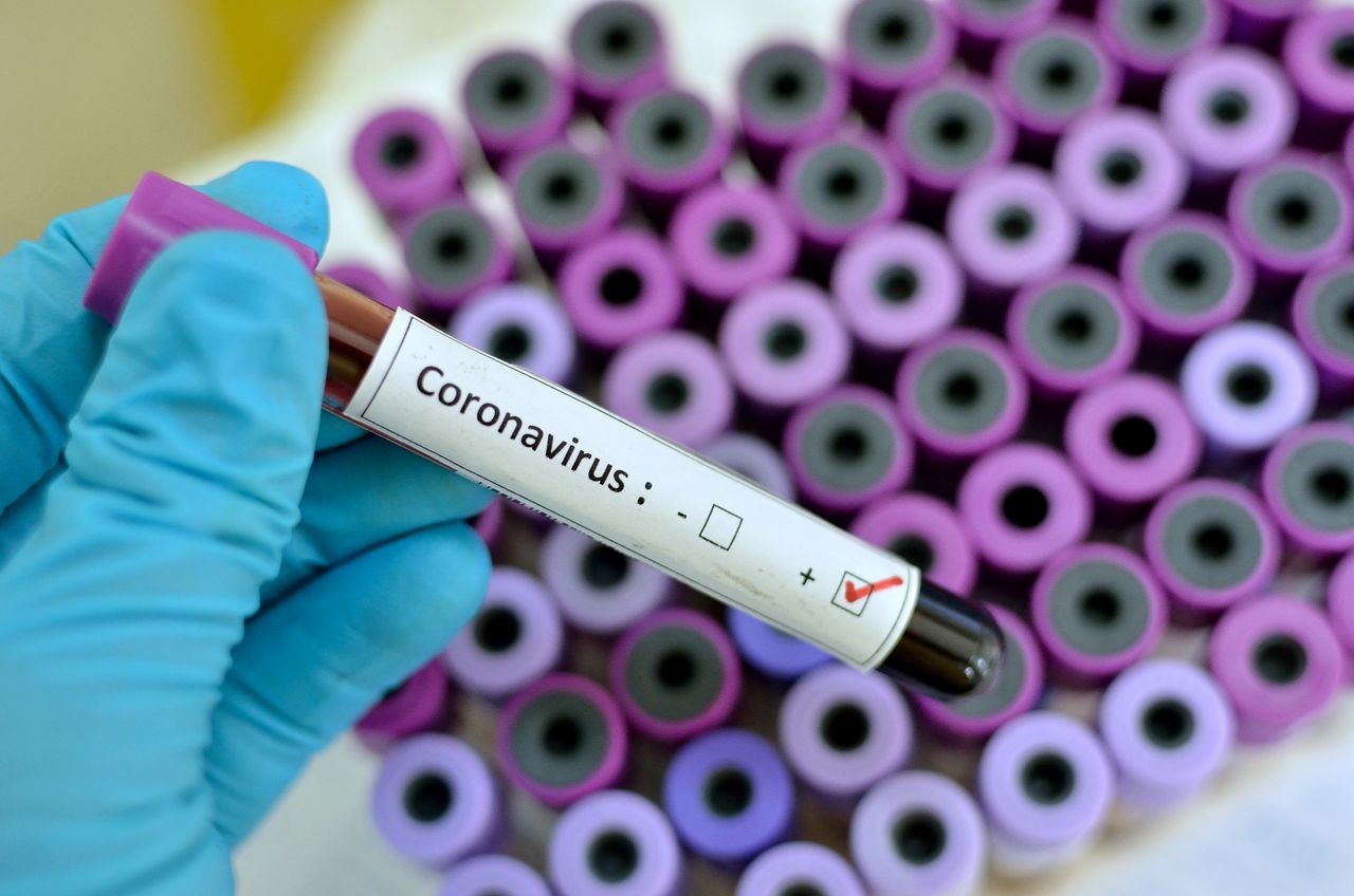 Grecja potwierdza doniesienia. Koronawirus w Salonikach 