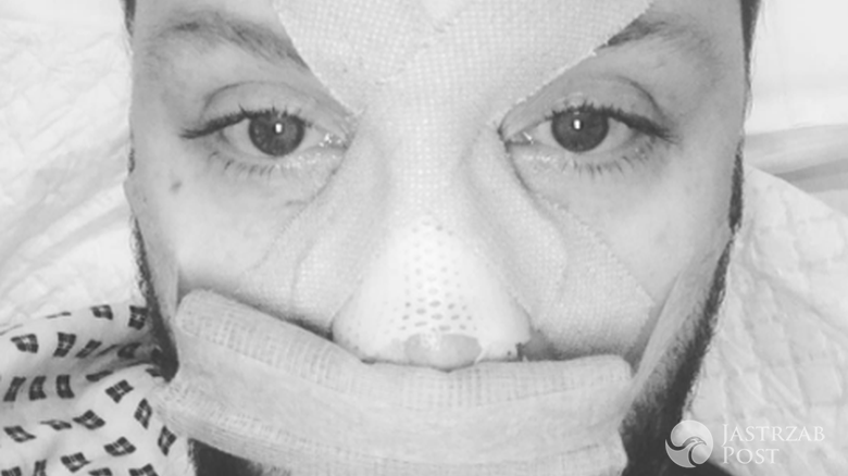 James Arthur trafił do szpitala