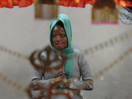 Co roku ponad tysiąc indyjskich kobiet staje się ofiarami ataku kwasem