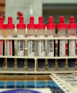 "Dam pracę, ale kandydat musi mieć grupę krwi AB"