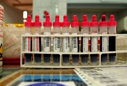 "Dam pracę, ale kandydat musi mieć grupę krwi AB"