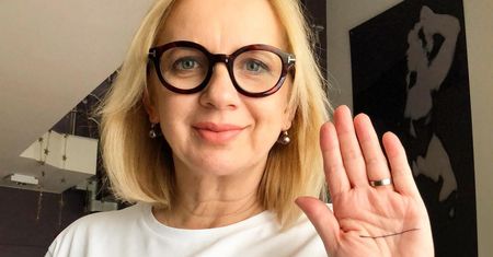 Akcja Linia Prosta a zespół Downa. Co oznacza linia na dłoni?