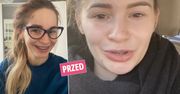 Ewelina Lisowska wcześniej ledwo otwierała usta, a teraz? Gwiazda pochwaliła się "nową twarzą". Zmiany widać gołym okiem. Ta metamorfoza zwala z nóg