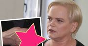 Katarzyna Figura powinna poddać się operacji dłoni! Odkłada ją, bo... To straszne!